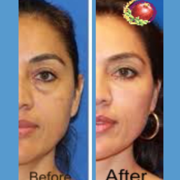 Retinol 18 Vitamin A Revolution Night Serum 30ml - Picture 6 of 14